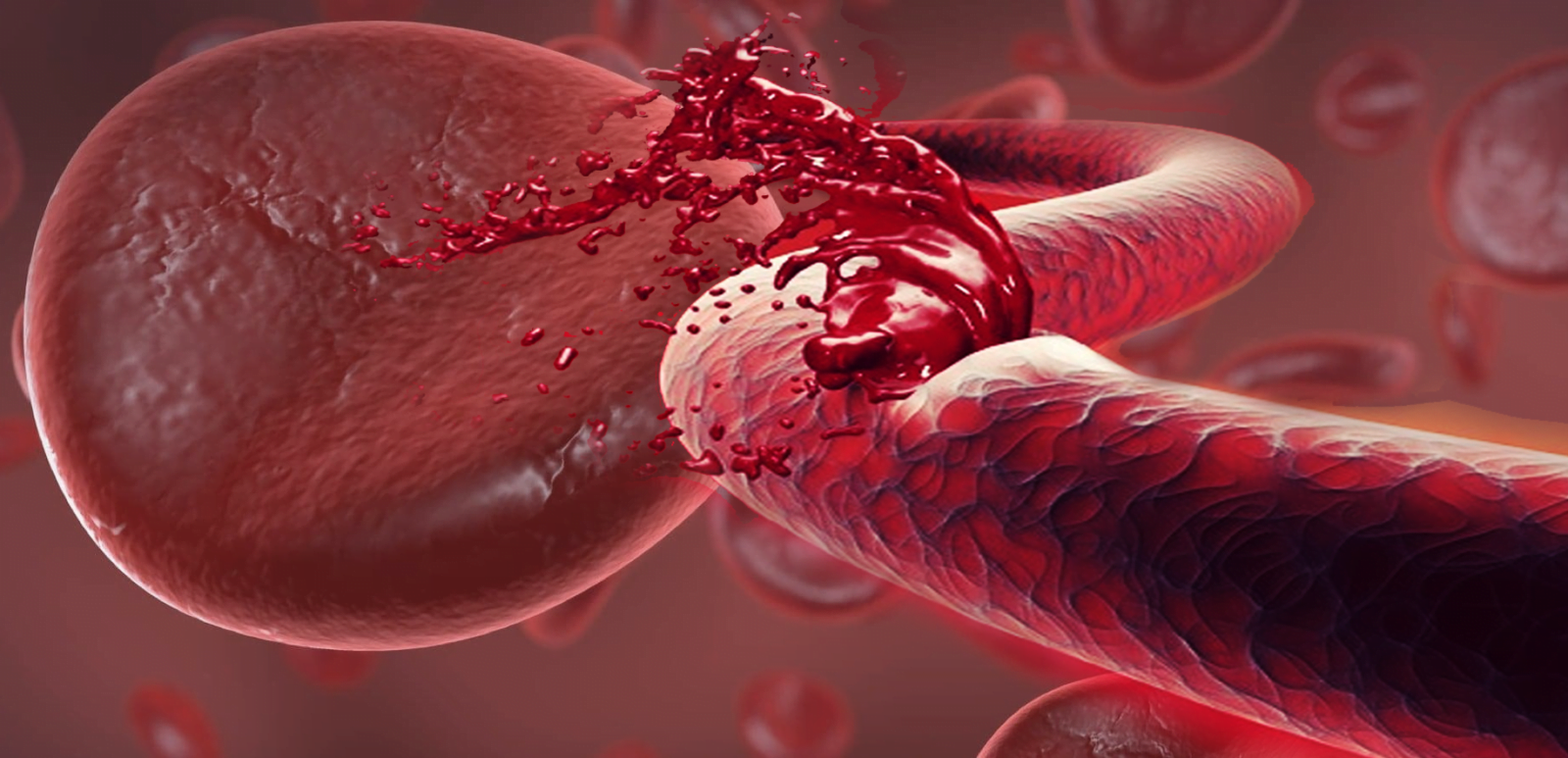 World Hemophilia Day